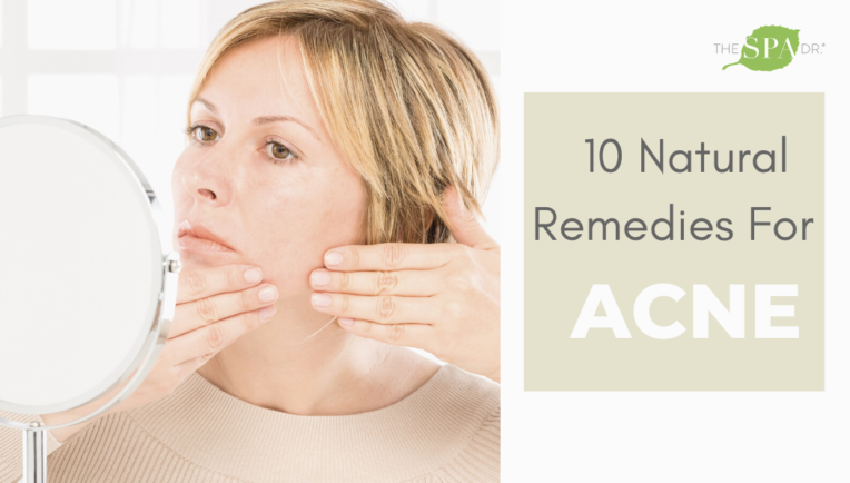Natural Acne Remedies