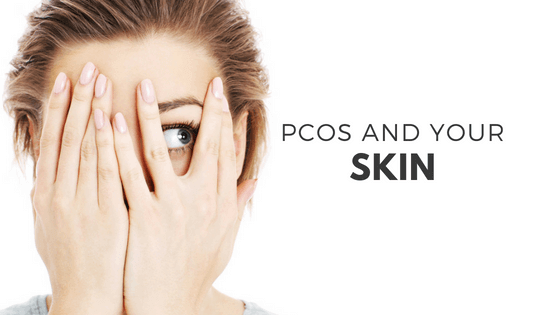 Pcos And Your Skin The Spa Dr®