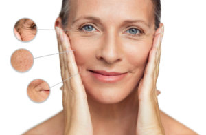 Signs of aging skin
