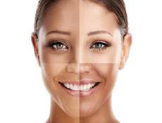 the spa dr skin type quiz